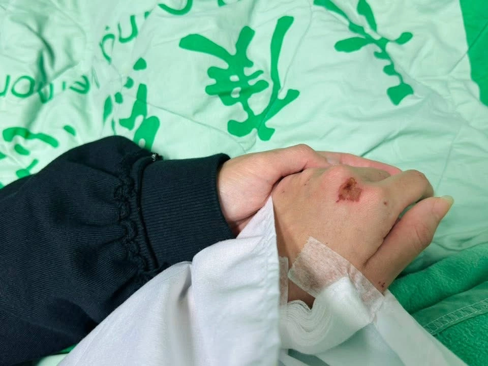 八點檔女星驚傳車禍遭撞飛！緊急開刀治療　劇組證實：角色將換人出演